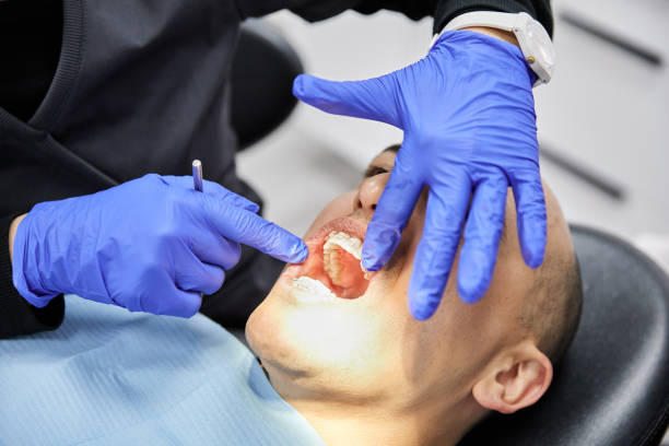 Best Emergency Dental Care for Broken or Chipped Teeth in Gulf Park Estates, MS